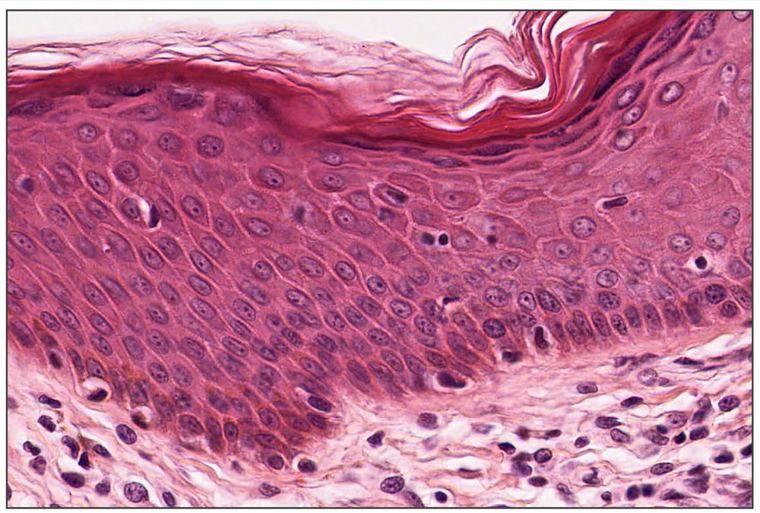Thin skin epidermis in H&E, showing the layers from the basal layer up to the pink keratin on the surface