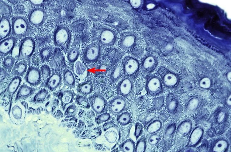Blue-stained epidermis with a red arrow pointing to a dark dendritic Langerhans cell among the spinosum cells