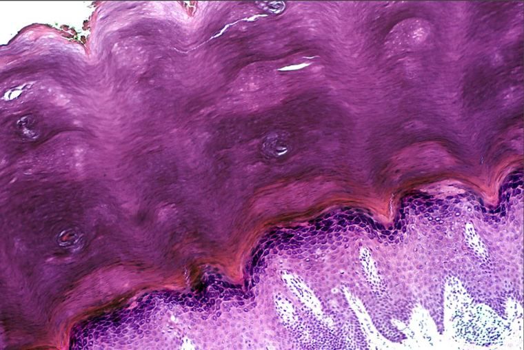Thick skin with a very thick, pale stratum corneum over deep epidermal ridges