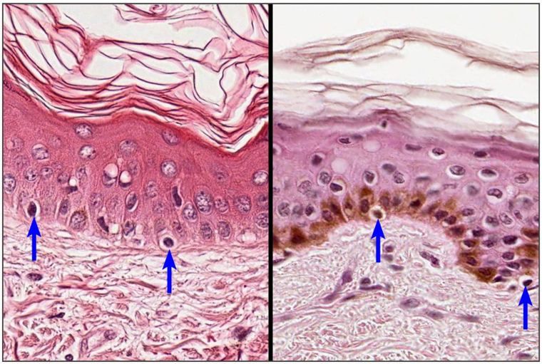 Two micrographs of the basal epidermis with blue arrows pointing to pale melanocytes, one in pigmented skin