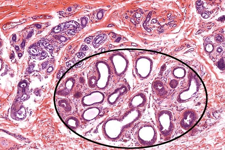 Dermis with a circled cluster of large glands with wide lumens