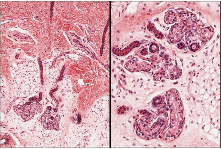 Dermis with coiled tubular glands cut in many places, enlarged on the right