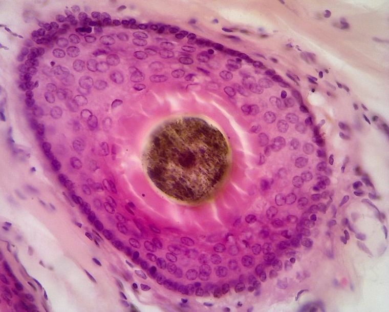 A hair follicle cut across: a pigmented hair in the center surrounded by rings of epithelial cells and connective tissue