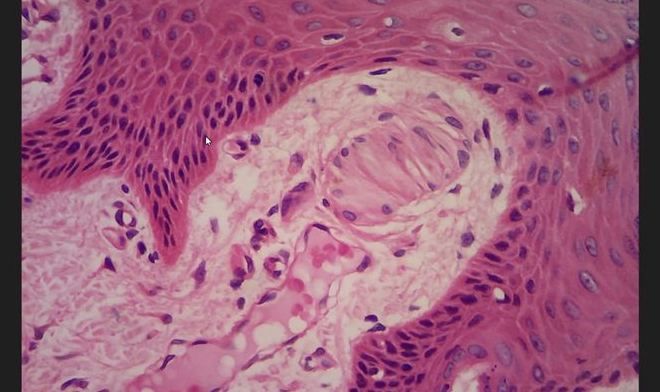 A dermal papilla containing an oval encapsulated nerve ending with transversely stacked cells