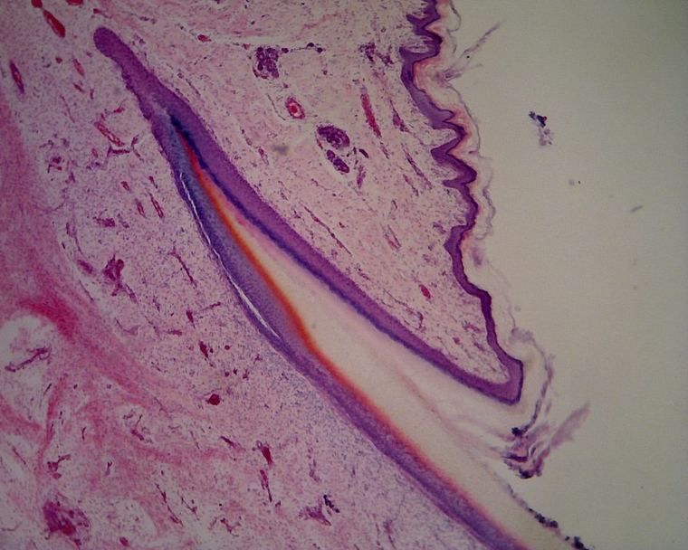 Longitudinal section of a fingertip showing the nail as a dense, darkly stained plate on the upper surface
