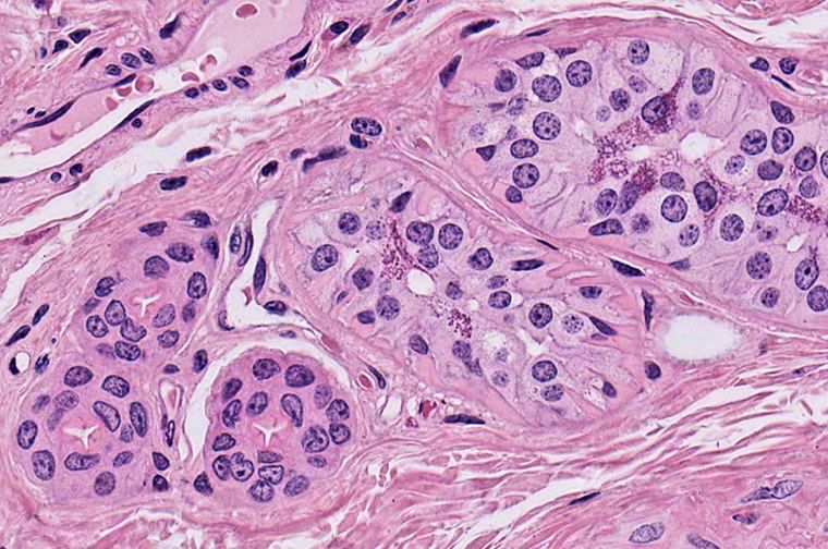 Secretory tubules of a sweat gland with a red arrow pointing to a flat cell at the edge of a tubule