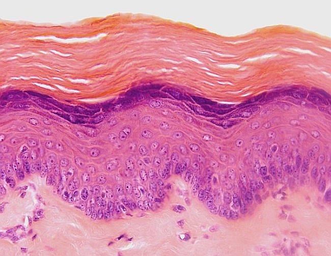 Stratified squamous non-keratinized epithelium of the esophagus