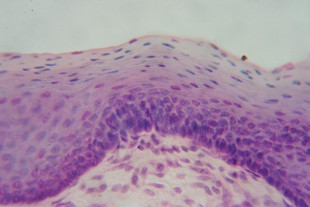 Stratified squamous keratinized epithelium of the skin