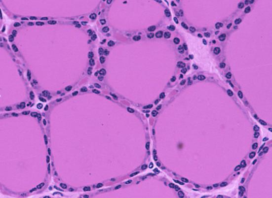 Simple cuboidal follicular cells of the thyroid gland
