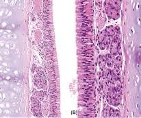 Pseudostratified ciliated columnar epithelium of the tracheal mucosa